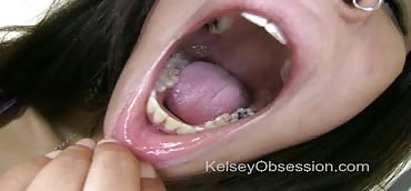 Mouth Fetish - Verta's Dental Exam